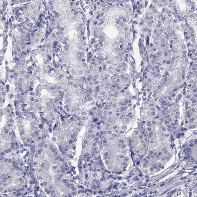 STAG3 Antibody in Immunohistochemistry (IHC)