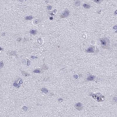 STAG3 Antibody in Immunohistochemistry (IHC)