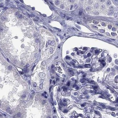 STAG3 Antibody in Immunohistochemistry (IHC)