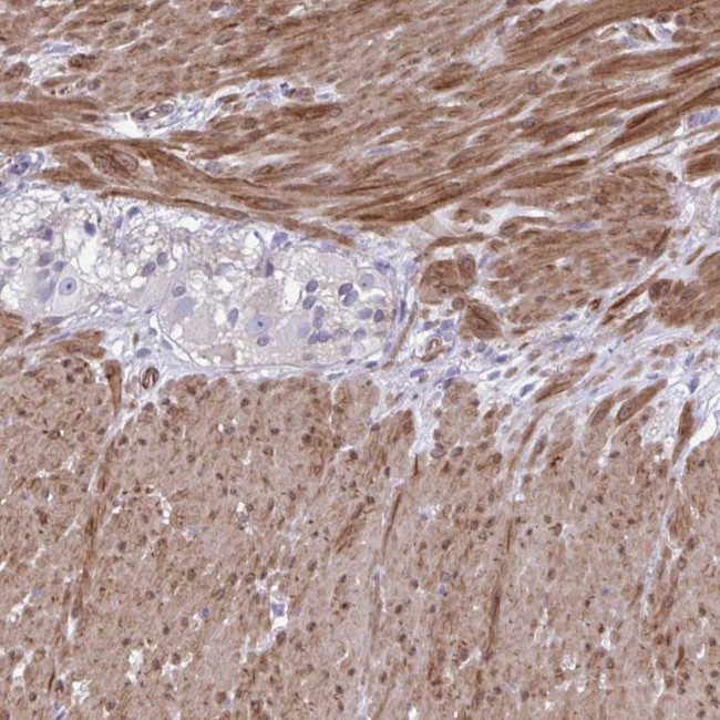 LIMS2 Antibody in Immunohistochemistry (IHC)