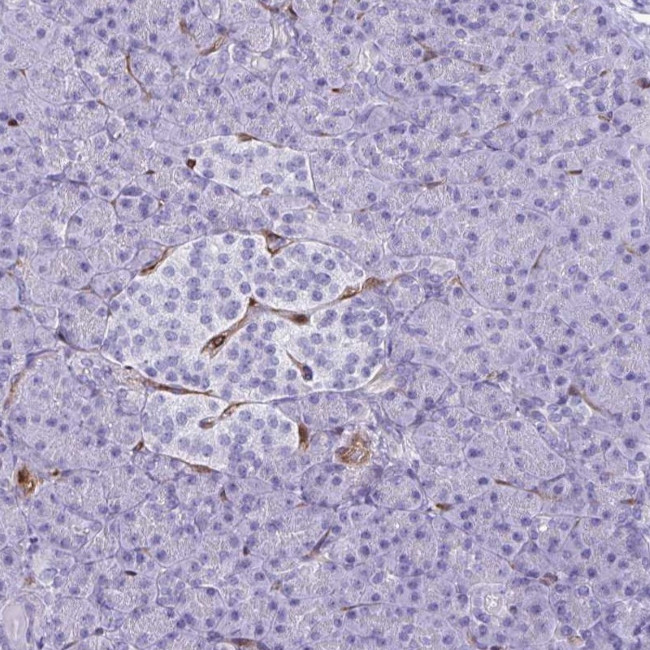 LIMS2 Antibody in Immunohistochemistry (IHC)