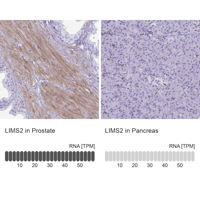 LIMS2 Antibody