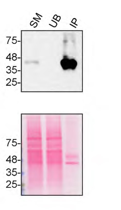 TMEM106B Antibody in Immunoprecipitation (IP)