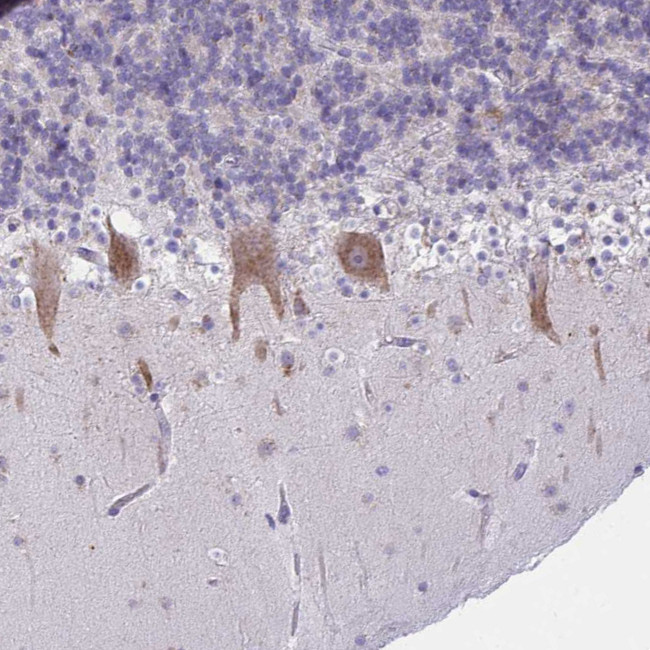 TMEM106B Antibody in Immunohistochemistry (IHC)