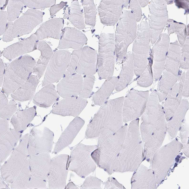 TMEM106B Antibody in Immunohistochemistry (IHC)