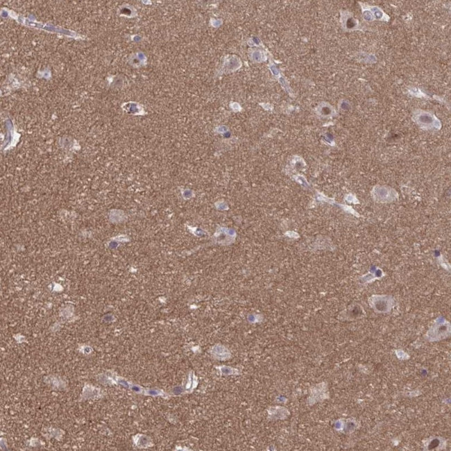 TTC7B Antibody in Immunohistochemistry (IHC)