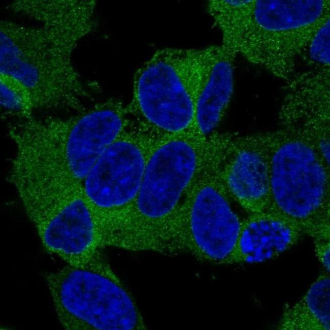 KIF21A Antibody in Immunocytochemistry (ICC/IF)