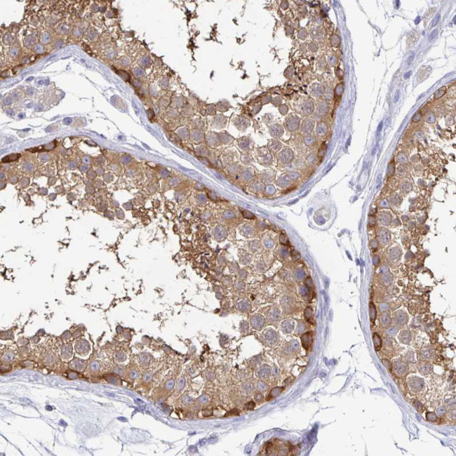 KIF21A Antibody in Immunohistochemistry (IHC)