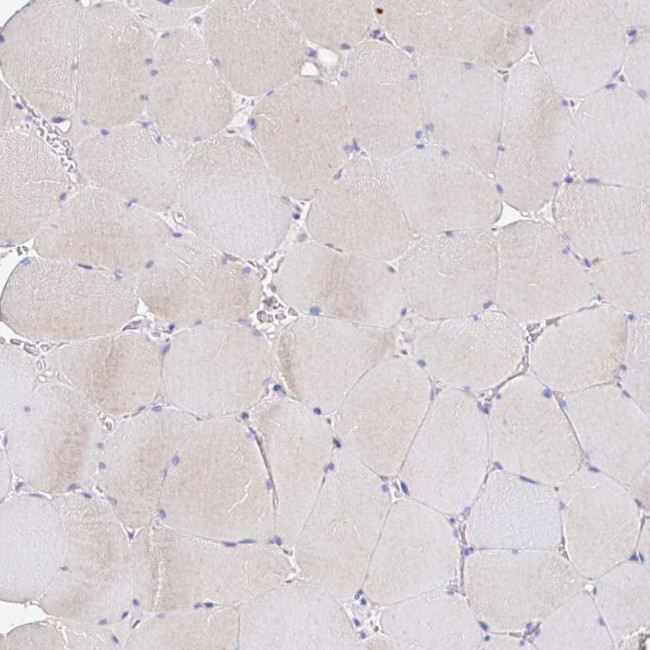 KIF21A Antibody in Immunohistochemistry (IHC)