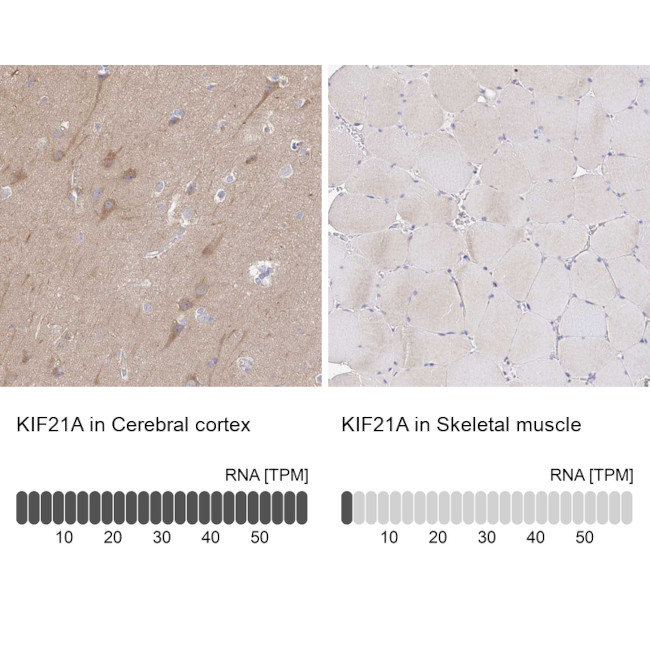 KIF21A Antibody