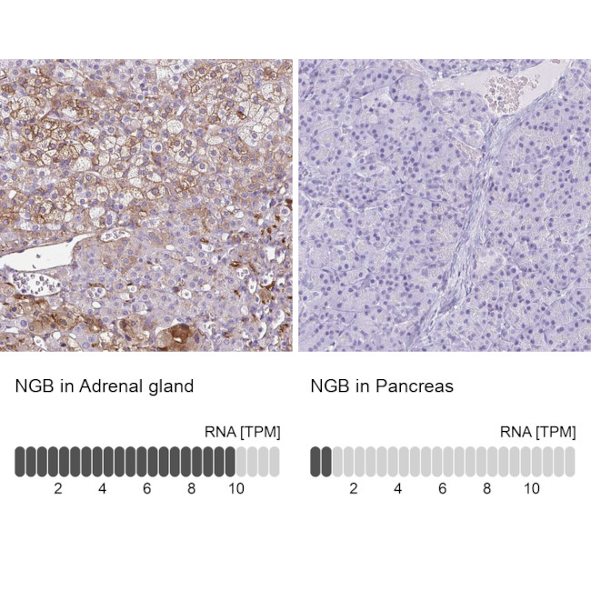 NGB Antibody in Immunohistochemistry (IHC)