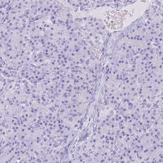 NGB Antibody in Immunohistochemistry (IHC)