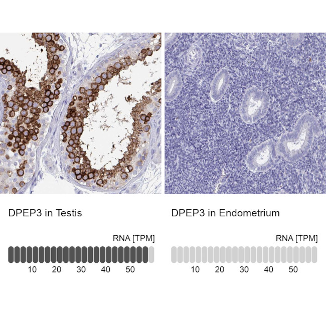 DPEP3 Antibody in Immunohistochemistry (IHC)