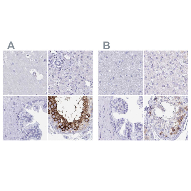 DPEP3 Antibody in Immunohistochemistry (IHC)