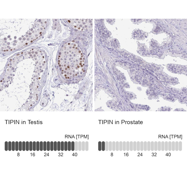 TIPIN Antibody