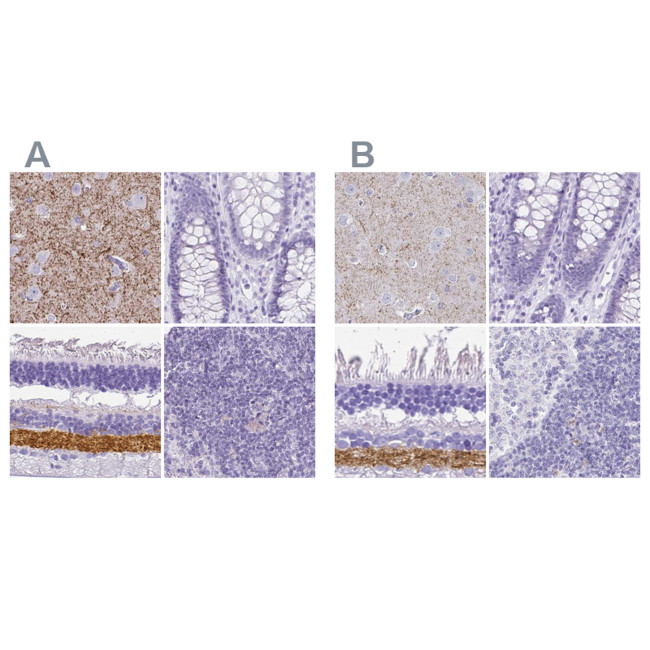 VGAT Antibody in Immunohistochemistry (IHC)