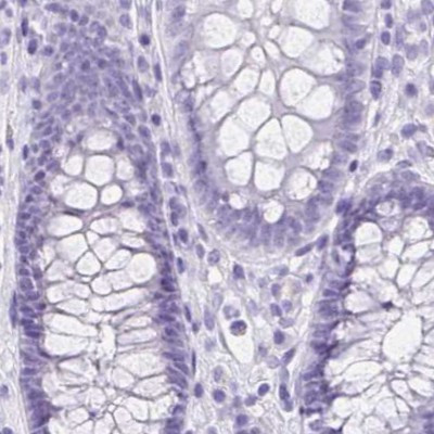 VGAT Antibody in Immunohistochemistry (IHC)