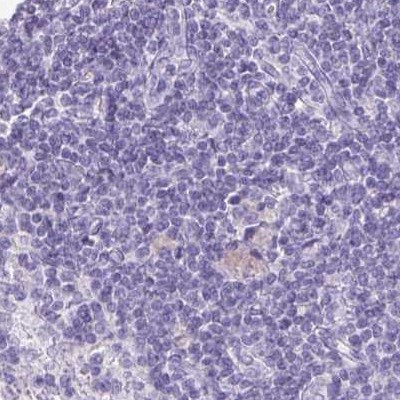 VGAT Antibody in Immunohistochemistry (IHC)