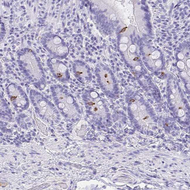 AVIL Antibody in Immunohistochemistry (IHC)