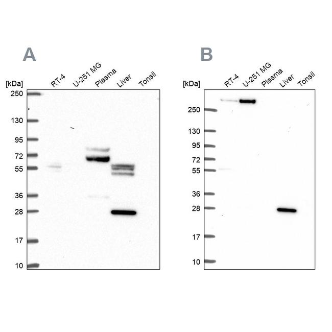 QDPR Antibody in Western Blot (WB)