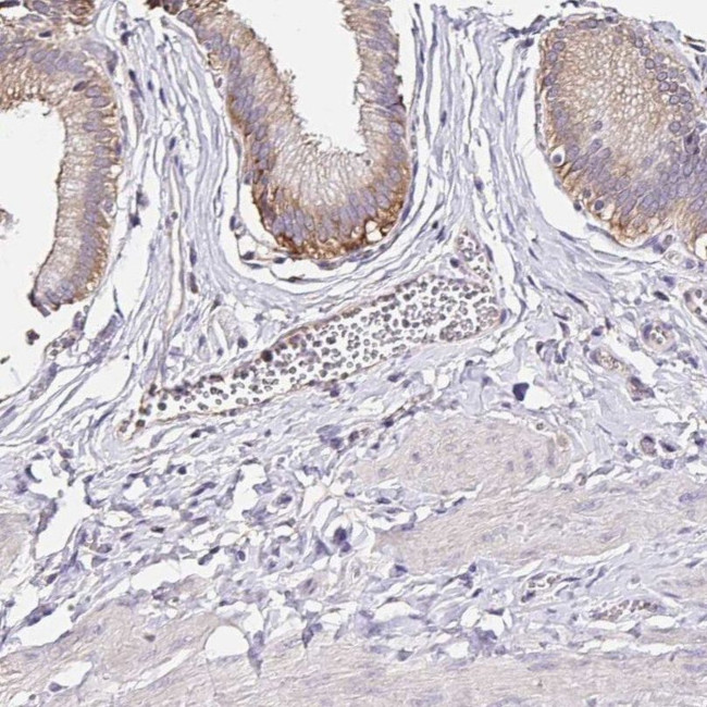 RSRP1 Antibody in Immunohistochemistry (IHC)