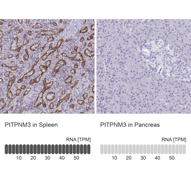 PITPNM3 Antibody in Immunohistochemistry (IHC)