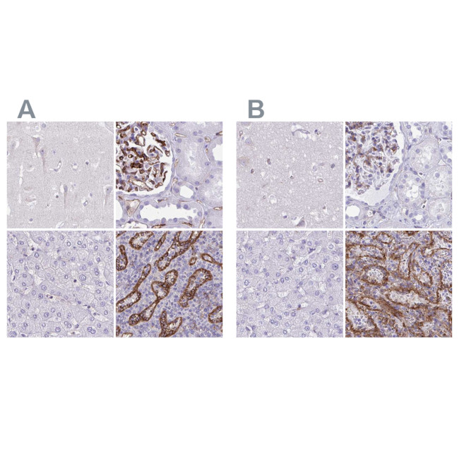 PITPNM3 Antibody in Immunohistochemistry (IHC)