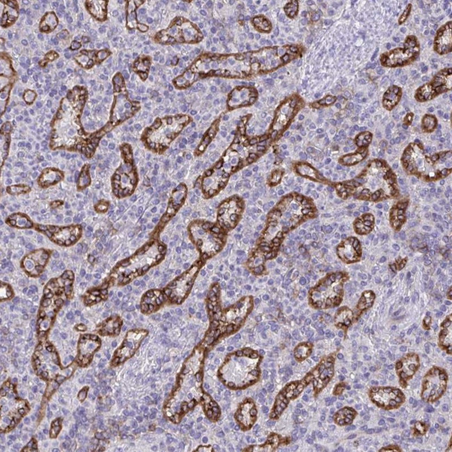 PITPNM3 Antibody in Immunohistochemistry (IHC)