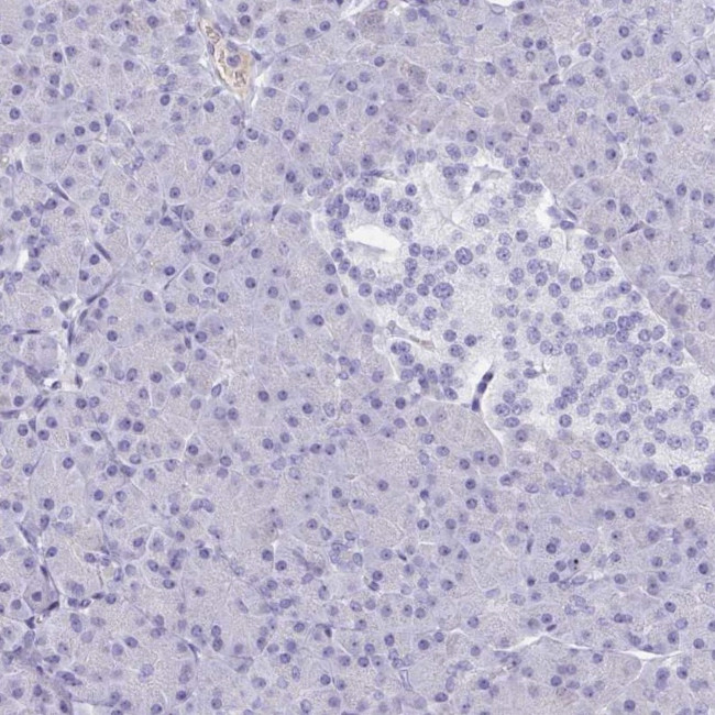 PITPNM3 Antibody in Immunohistochemistry (IHC)