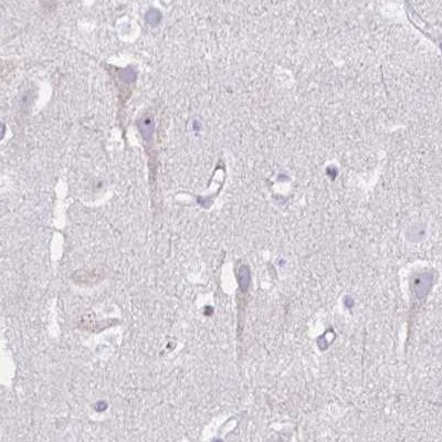 PITPNM3 Antibody in Immunohistochemistry (IHC)