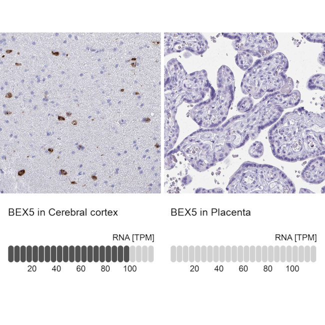 BEX5 Antibody in Immunohistochemistry (IHC)