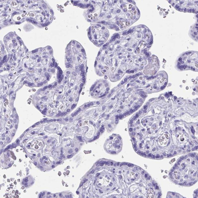 BEX5 Antibody in Immunohistochemistry (IHC)