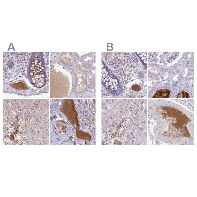 HGF Activator Antibody in Immunohistochemistry (IHC)