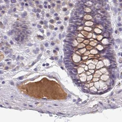 HGF Activator Antibody in Immunohistochemistry (IHC)