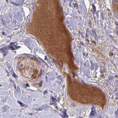 HGF Activator Antibody in Immunohistochemistry (IHC)