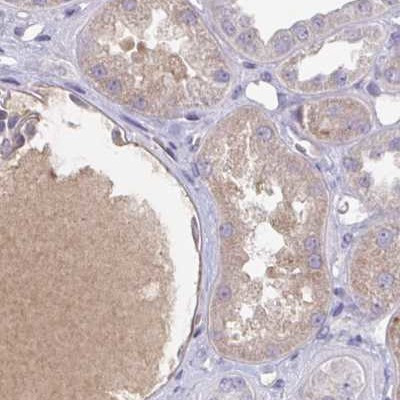 HGF Activator Antibody in Immunohistochemistry (IHC)