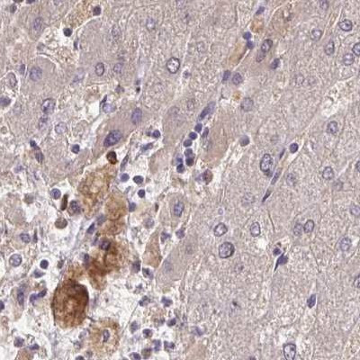 HGF Activator Antibody in Immunohistochemistry (IHC)