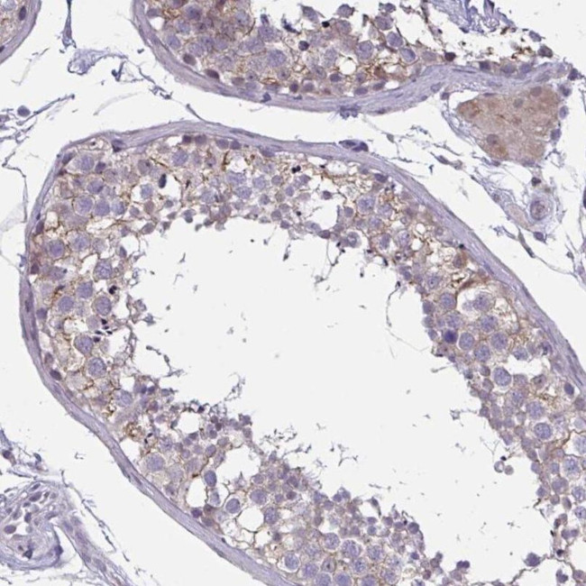 TCEAL8 Antibody in Immunohistochemistry (IHC)