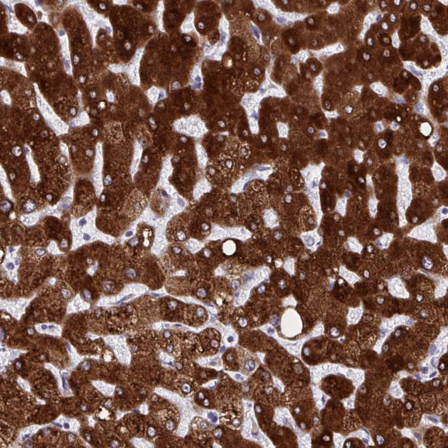 HSD17B6 Antibody in Immunohistochemistry (IHC)