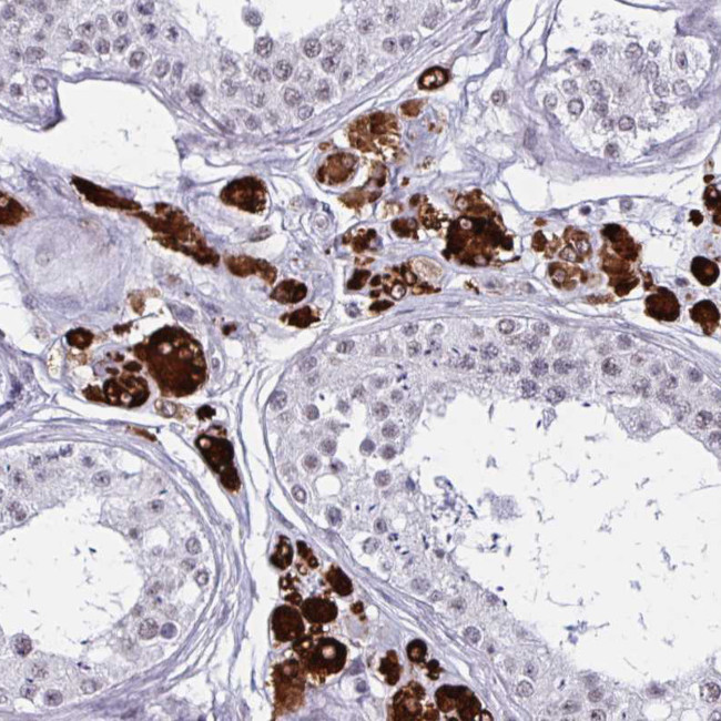 HSD17B6 Antibody in Immunohistochemistry (IHC)