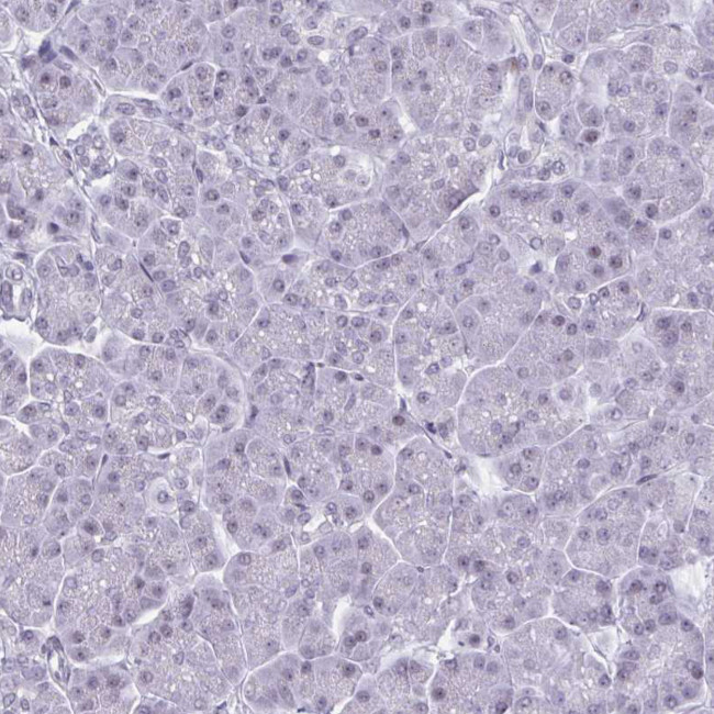 HSD17B6 Antibody in Immunohistochemistry (IHC)