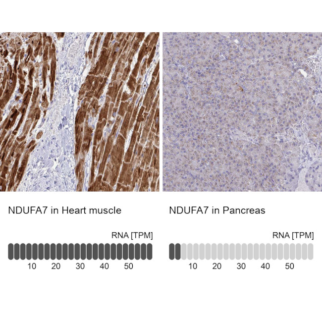 NDUFA7 Antibody in Immunohistochemistry (IHC)