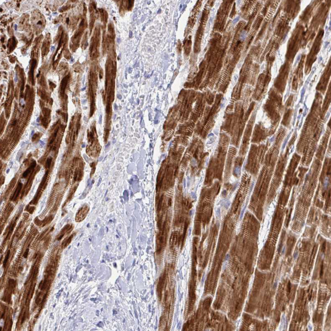 NDUFA7 Antibody in Immunohistochemistry (IHC)