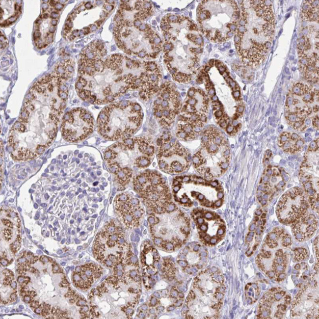 NDUFA7 Antibody in Immunohistochemistry (IHC)