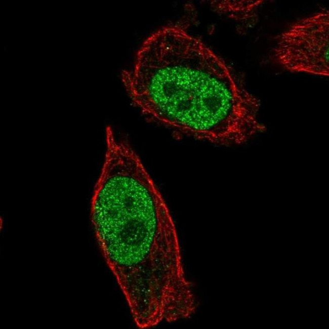 ABHD16B Antibody in Immunocytochemistry (ICC/IF)