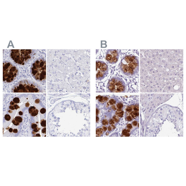 CLCA1 Antibody in Immunohistochemistry (IHC)