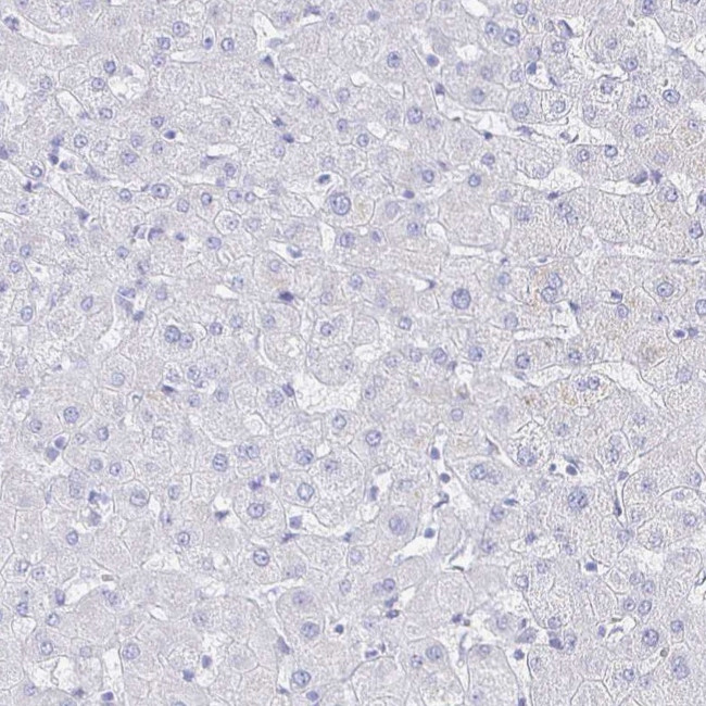 CLCA1 Antibody in Immunohistochemistry (IHC)