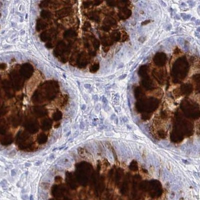 CLCA1 Antibody in Immunohistochemistry (IHC)