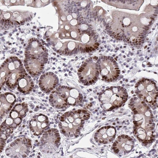 ZFHX3 Antibody in Immunohistochemistry (IHC)