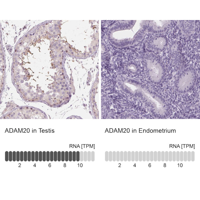 ADAM20 Antibody in Immunohistochemistry (IHC)